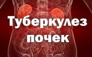 Туберкулез почек