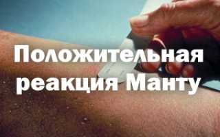 Что делать, если реакция Манту положительная?