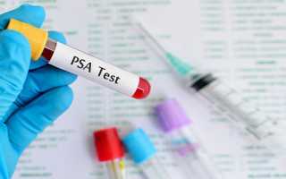 Анализ крови ПСА общий при простатите – норма и отклонения