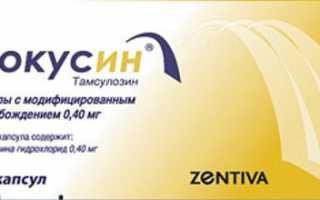 Лечение предстательной железы Фокусином