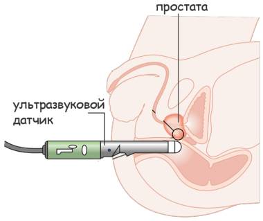 ТРУЗИ железы